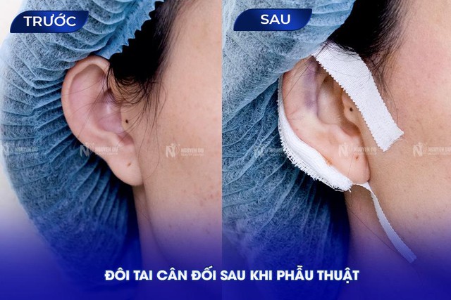 Bác sĩ Lý Tấn Việt - bác sĩ chỉnh hình tai vểnh tại TP.HCM- Ảnh 2.