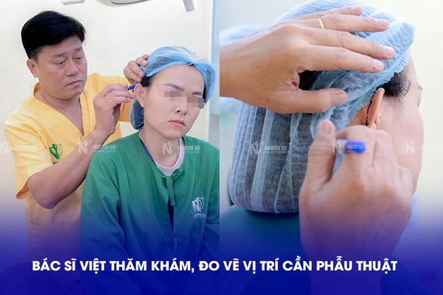 Bác sĩ Lý Tấn Việt - bác sĩ chỉnh hình tai vểnh tại TP.HCM- Ảnh 3.