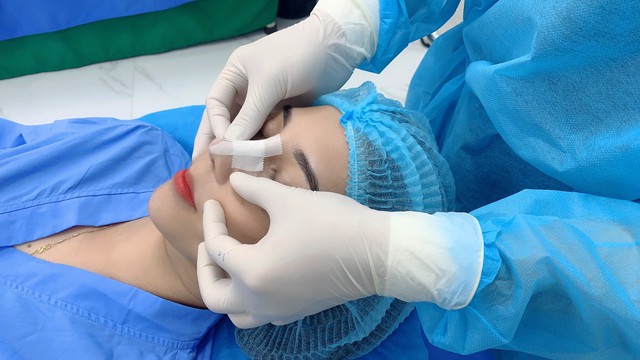Sẹo lồi sau nâng mũi: Nguyên nhân và cách điều trị hiệu quả- Ảnh 4.
