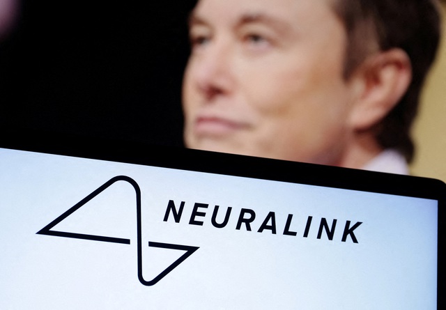 Neuralink của tỉ phú Elon Musk được cấp phép cấy chip vào não người như thế nào?- Ảnh 5.