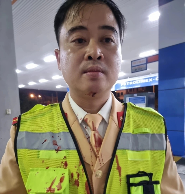 Quảng Ninh: Tạm giữ người vi phạm giao thông, tông ngã đại úy công an- Ảnh 2.