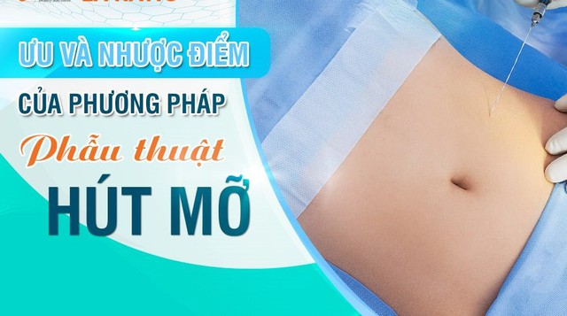 'Bụng to' là tướng làm quan, nhưng ai cũng muốn đi tìm vòng eo năm nào- Ảnh 1.