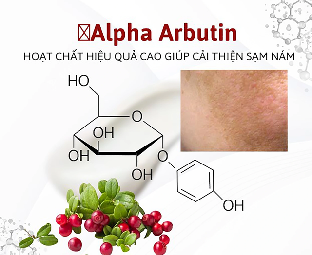 Alpha Arbutin là gì? Tại sao được ứng dụng phổ biến trong trị nám, trắng da?- Ảnh 2.