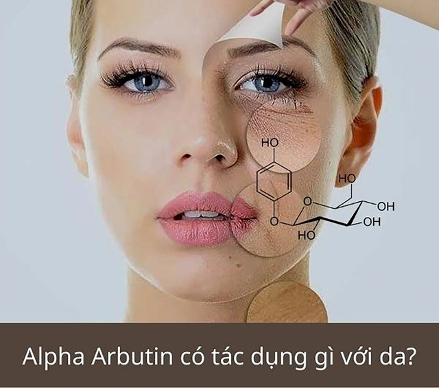 Alpha Arbutin là gì? Tại sao được ứng dụng phổ biến trong trị nám, trắng da?- Ảnh 4.