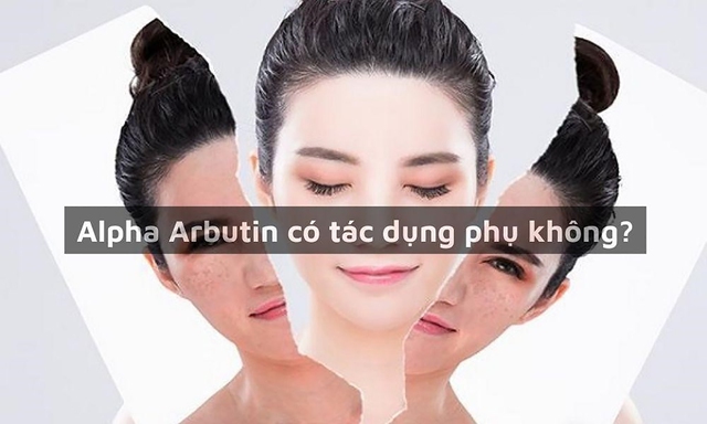 Alpha Arbutin là gì? Tại sao được ứng dụng phổ biến trong trị nám, trắng da?- Ảnh 5.