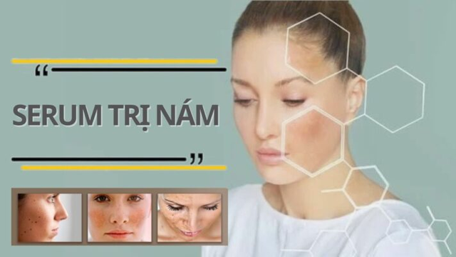 serum trị nám