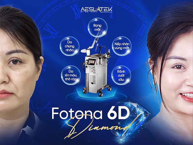 Aeslatek - b&iacute; quyết trẻ h&oacute;a l&agrave;n da với c&ocirc;ng nghệ Fotona SP Dynamis NX Line- Ảnh 1.