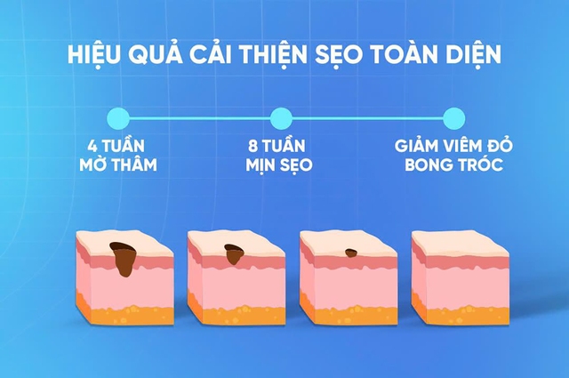 Làm thế nào để ngăn ngừa và điều trị sẹo sau phẫu thuật hiệu quả tại nhà?- Ảnh 11.