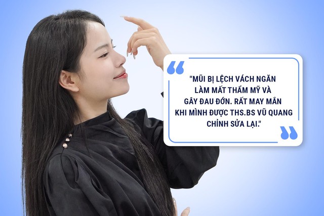 Nâng mũi - mối đe dọa đến nhan sắc và sức khỏe- Ảnh 4. Nâng mũi - mối đe dọa đến nhan sắc và sức khỏe- Ảnh 4.