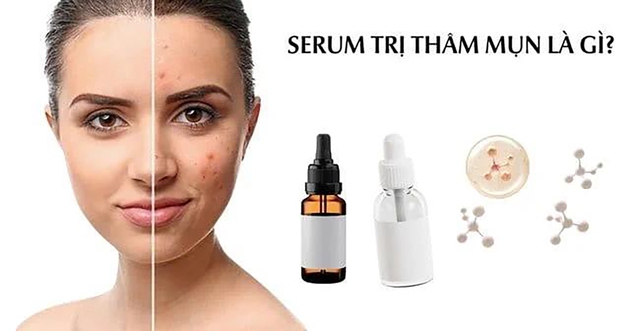 Top 10 serum trị thâm mụn cho làn da tươi sáng rạng ngời được tìm mua nhiều- Ảnh 1.