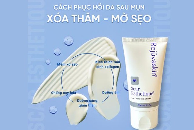 Tại sao mụn viêm khiến da có sẹo?- Ảnh 5.