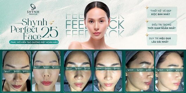 Phác đồ Shynh Perfect Face 25 là sự kết hợp giữa công nghệ thẩm mỹ cao cấp và thẩm mỹ nội khoa, với những kỹ thuật độc quyền từ hội đồng bác sĩ của Shynh Premium