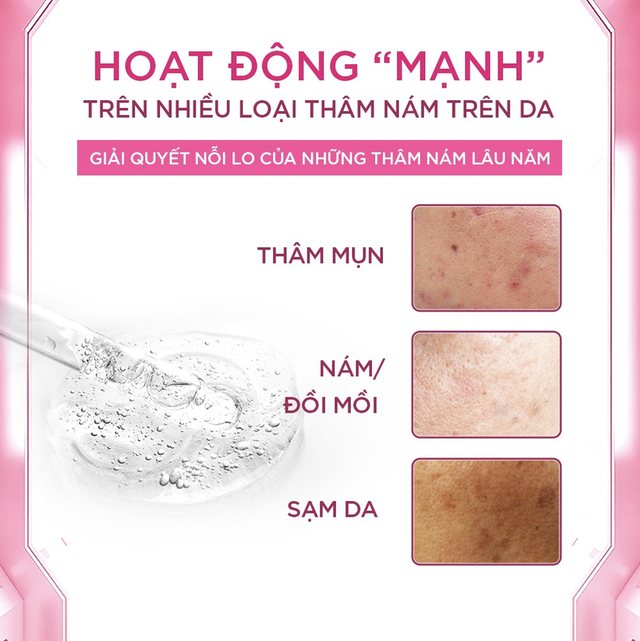 Hướng dẫn sử dụng serum trị nám PageOne Tranacide Pro + Exosome hiệu quả chỉ 6 tuần- Ảnh 5.