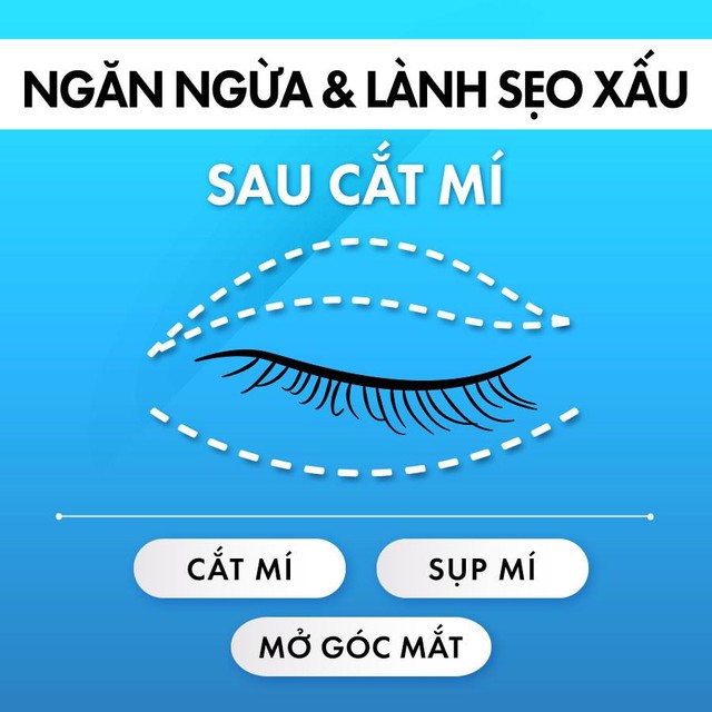 Kem trị sẹo sau cắt mí nào đang được tìm mua nhiều hàng đầu hiện nay?- Ảnh 6.