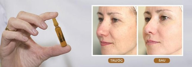 Top 10 serum xóa mờ nếp nhăn, vết chân chim cho làn da căng mịn, sáng khỏe- Ảnh 5.