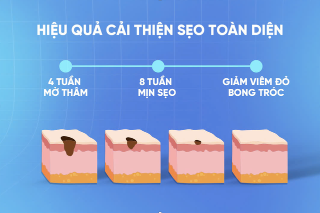 Kem trị sẹo thâm ở chân nào hiệu quả ngay tại nhà mà không cần xâm lấn?- Ảnh 5.