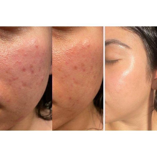 Tổng kết 5 Retinol không gây bong tróc có lượt bán cao hàng đầu năm 2024- Ảnh 10.