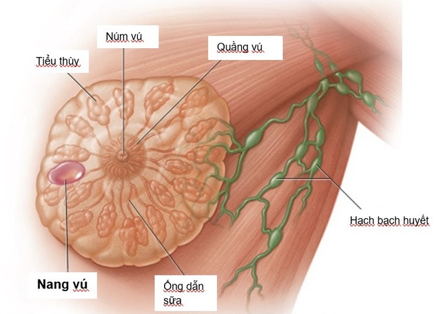 Báo động tỷ lệ mắc ung thư tại Việt Nam- Ảnh 2.