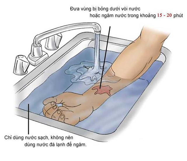 Bật mí ‘siêu phẩm’ kem trị sẹo bỏng dù có hết tiền vẫn phải mua lại- Ảnh 3.