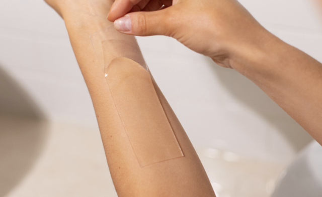 Miếng dán Silicone Y tế và Steroid trị sẹo lồi, nên dùng loại nào?- Ảnh 1.