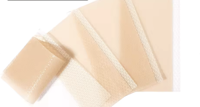 Miếng dán Silicone Y tế và Steroid trị sẹo lồi, nên dùng loại nào?- Ảnh 2.