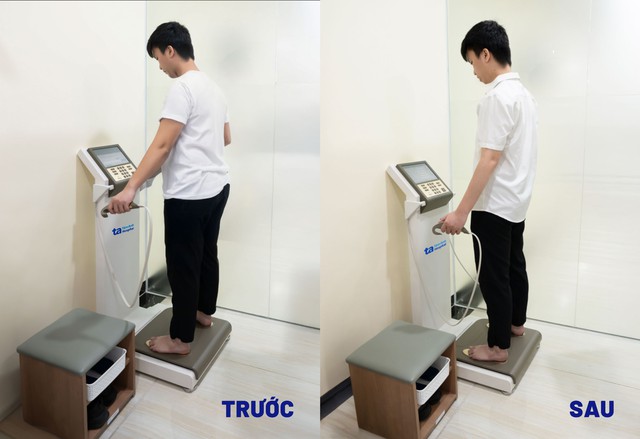 Khách hàng trước và sau điều trị tại Trung tâm Giảm cân Tâm Anh