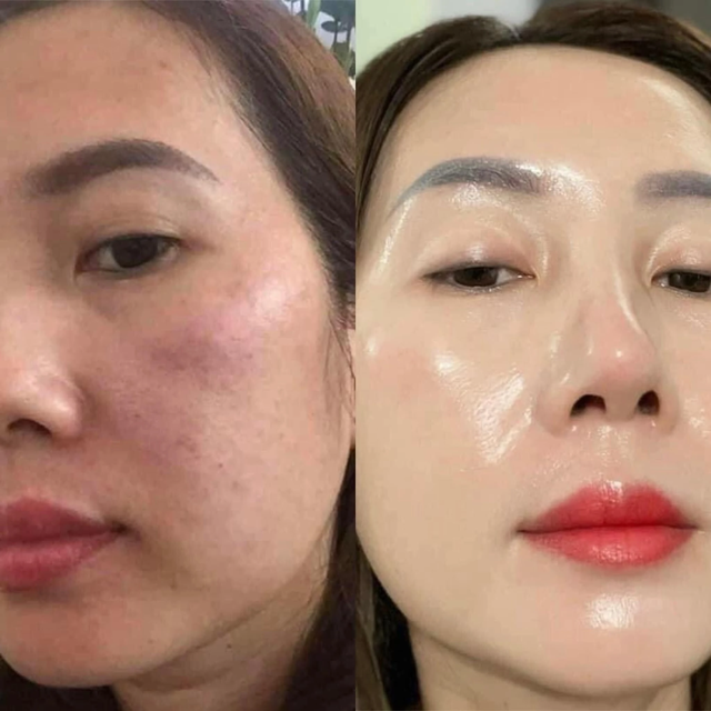 Top 10 serum Niacinamide đang được mua đi mua lại hàng ngàn lần trên Tiktok- Ảnh 13.