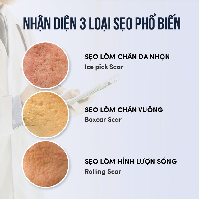 Sẹo lõm có tự đầy không? Cách trị sẹo lõm lấy lại làn da mịn màng- Ảnh 3.