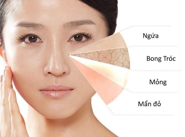 Da nhạy cảm có nên dùng sản phẩm chăm sóc da chứa Retinol?- Ảnh 2.