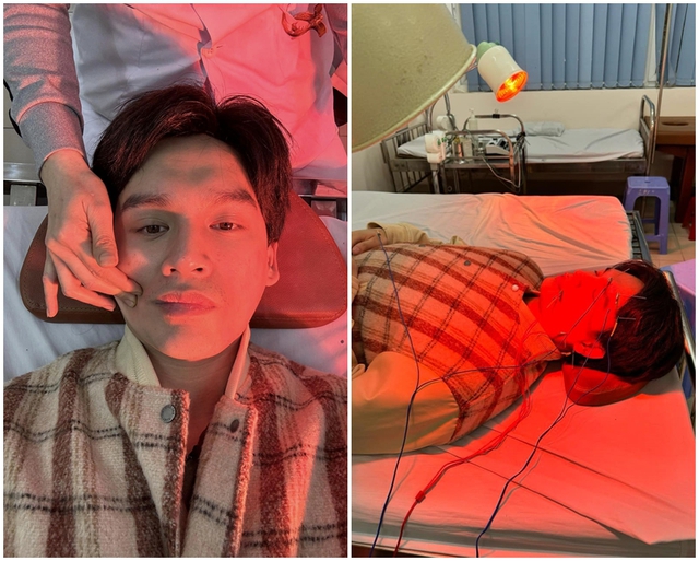 Ca sĩ Nguyễn Trần Trung Quân gặp triệu chứng liệt dây thần kinh số 7, méo miệng- Ảnh 1.