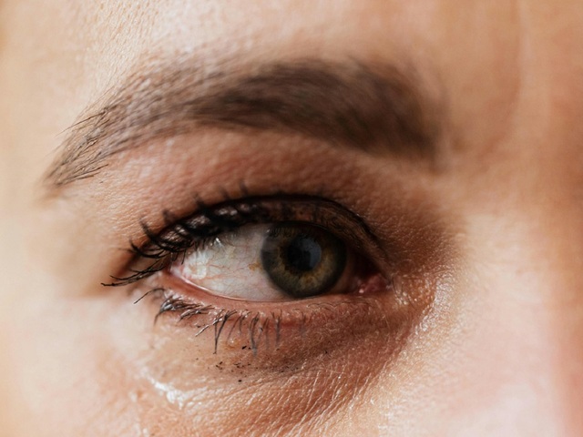 Khô mắt kéo dài tác động tiêu cực đến sức khỏe- Ảnh 1.
