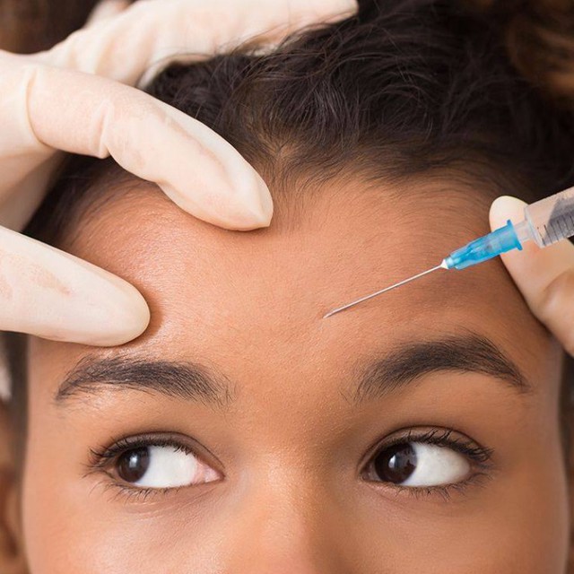 'Thần dược' chống nhăn daxxify có thực sự bỏ xa đối thủ botox hay không?- Ảnh 4.