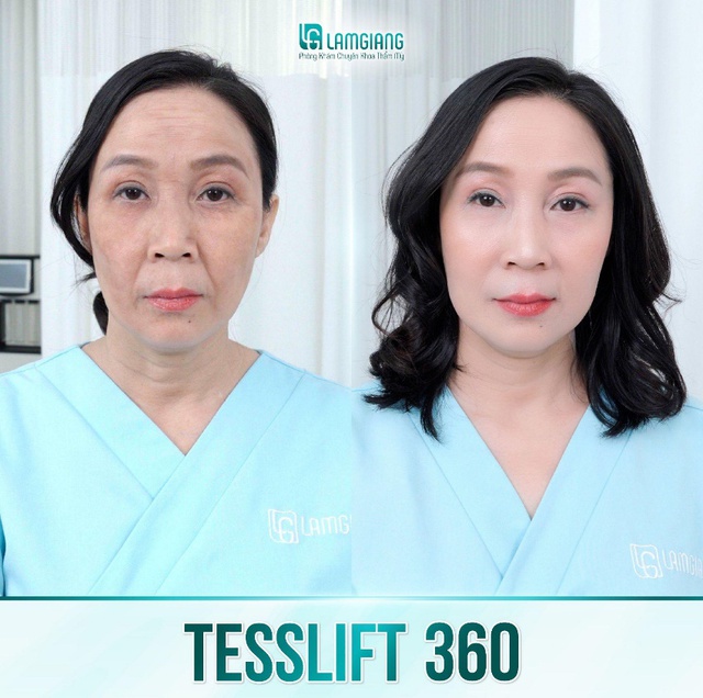 Phòng khám Thẩm mỹ Lam Giang ký kết chuyển giao độc quyền Trẻ hóa da TESSLIFT 360- Ảnh 3.