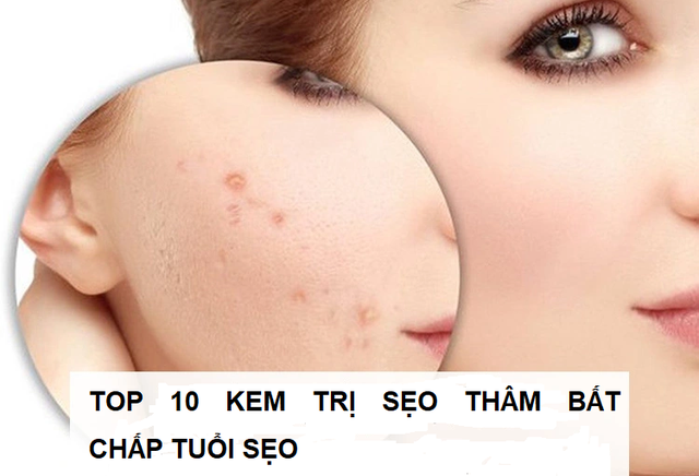 Top 10 kem trị sẹo thâm hiệu quả cho làn da mềm mịn, tươi sáng đều màu- Ảnh 1.