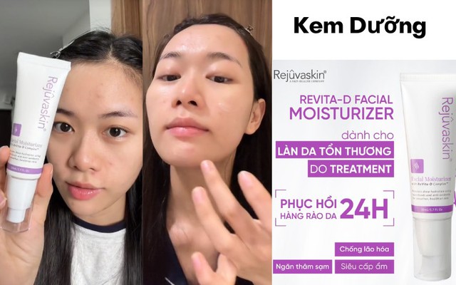 Kem dưỡng ẩm ngừa lão hóa da Rejuvaskin Facial Moisturizer