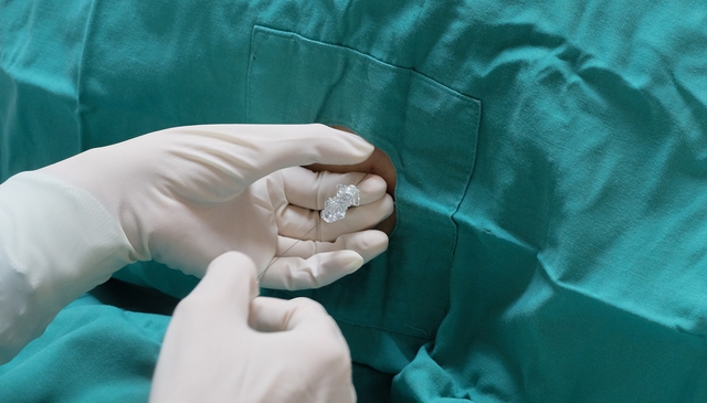 Bệnh nhân được chọc dò tủy sống để xác định tình trạng viêm màng não. Nguồn Shutterstock