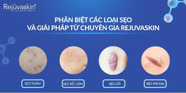 Giải mã nguyên nhân dùng kem trị sẹo mà vẫn không hiệu quả- Ảnh 2.