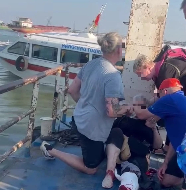 Vụ tai nạn khiến 2 du khách nước ngoài bị gãy chân trái và 1 hướng dẫn viên người Việt bị thương nặng