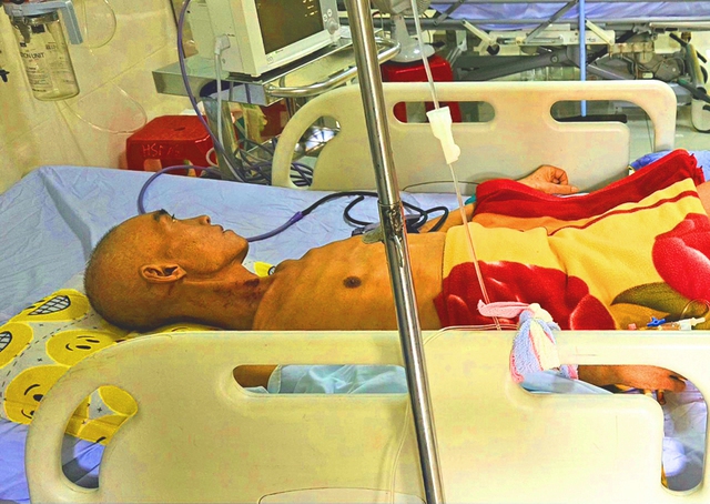 Anh Đang đang điều trị tại Bệnh viện đa khoa tỉnh Bình Định