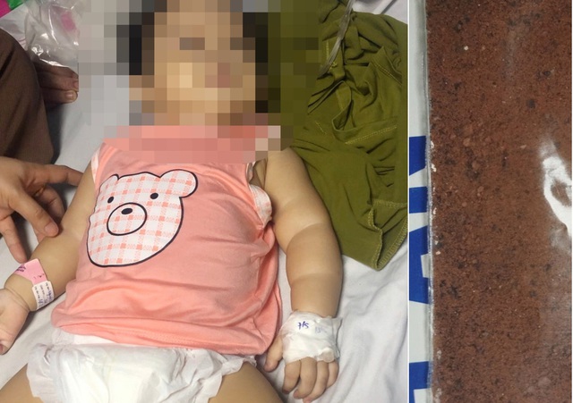 Bé gái 11 tháng tuổi ngộ độc nguy kịch do dùng ‘thuốc cam’ gia truyền- Ảnh 1.
