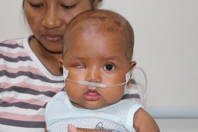 Siu Nữ bị ung thư mắt khi mới 2 tháng tuổi