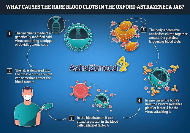 Các nhà khoa học tin rằng họ đã giải đáp được bí ẩn đằng sau những cục máu đông cực hiếm do vắc xin AstraZeneca gây ra