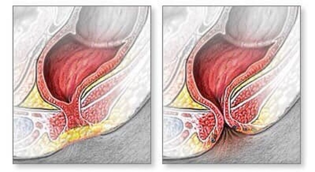 Phát hiện sớm trẻ sơ sinh không có lỗ hậu môn trong hiếm gặp- Ảnh 1.