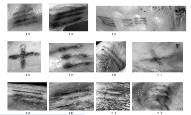 Hình xăm của Otzi được chụp bằng phần mềm xử lý hình ảnh, có thể là một phần của kỹ thuật chữa bệnh cổ xưa