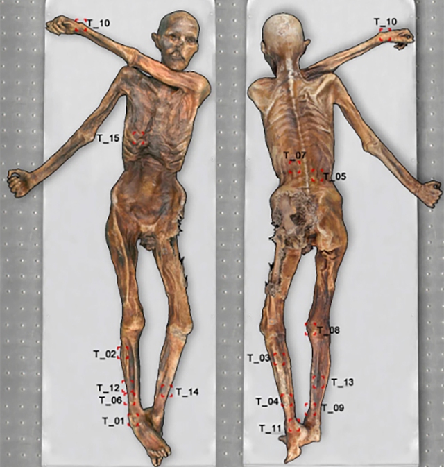 Otzi có hình xăm ở một số vùng trên cơ thể