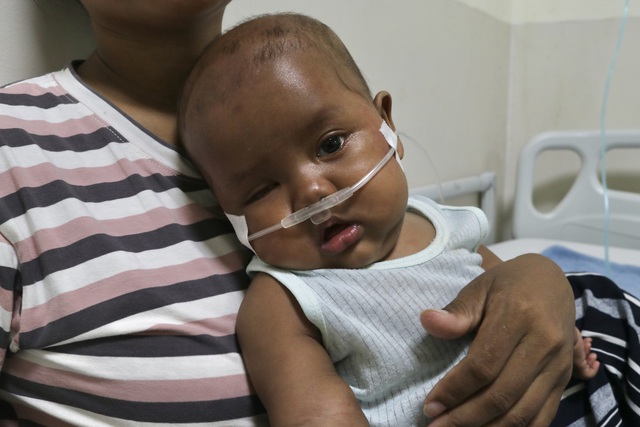 'Con muốn sống': Xin cứu mắt còn lại của bé gái Ba Na 7 tháng tuổi- Ảnh 3.