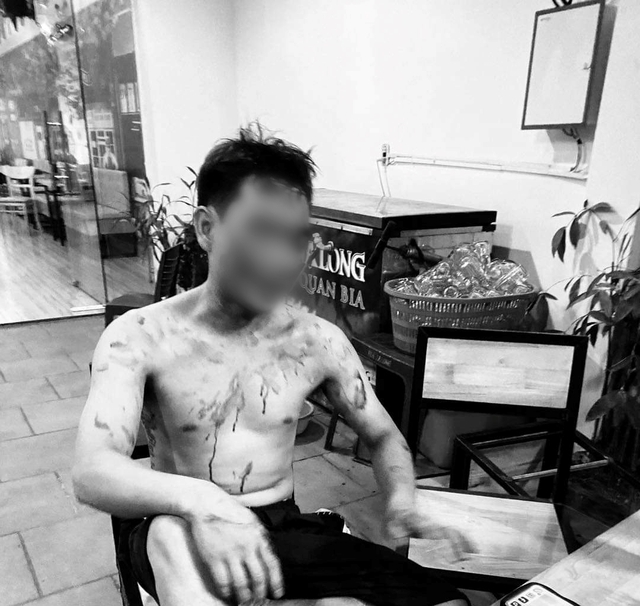 Một thanh niên bị hành hung dã man tại phòng trà - Ảnh 1.