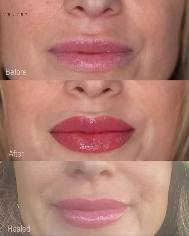 Lip Blush 'đánh má hồng' cho môi đang tạo cơn sốt làm đẹp trên TikTok- Ảnh 2.