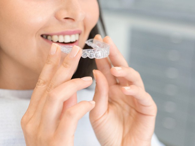 Chăm sóc hàm duy trì sau khi niềng răng hiệu quả nhất từ nha sĩ- Ảnh 3.