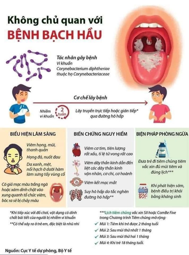 Dấu hiệu nghiêm trọng do bệnh bạch hầu- Ảnh 1.